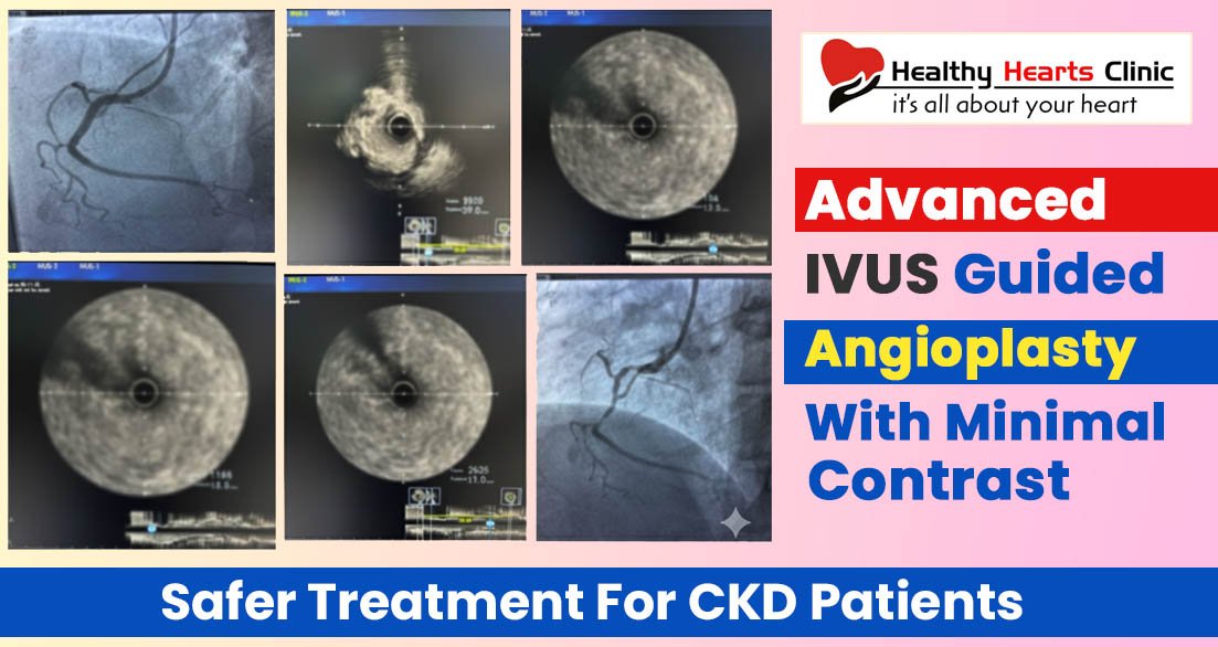 angioplasty-for-ckd-disease