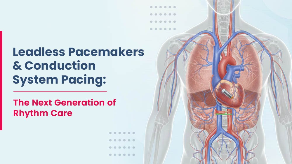 leadless-pacemkaer-and-conduction-pacing